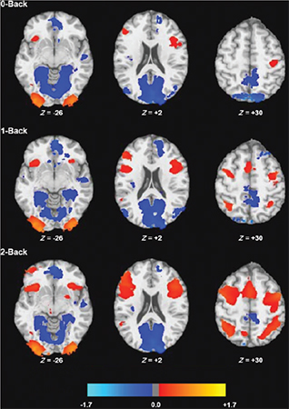 fMRI images of the brain