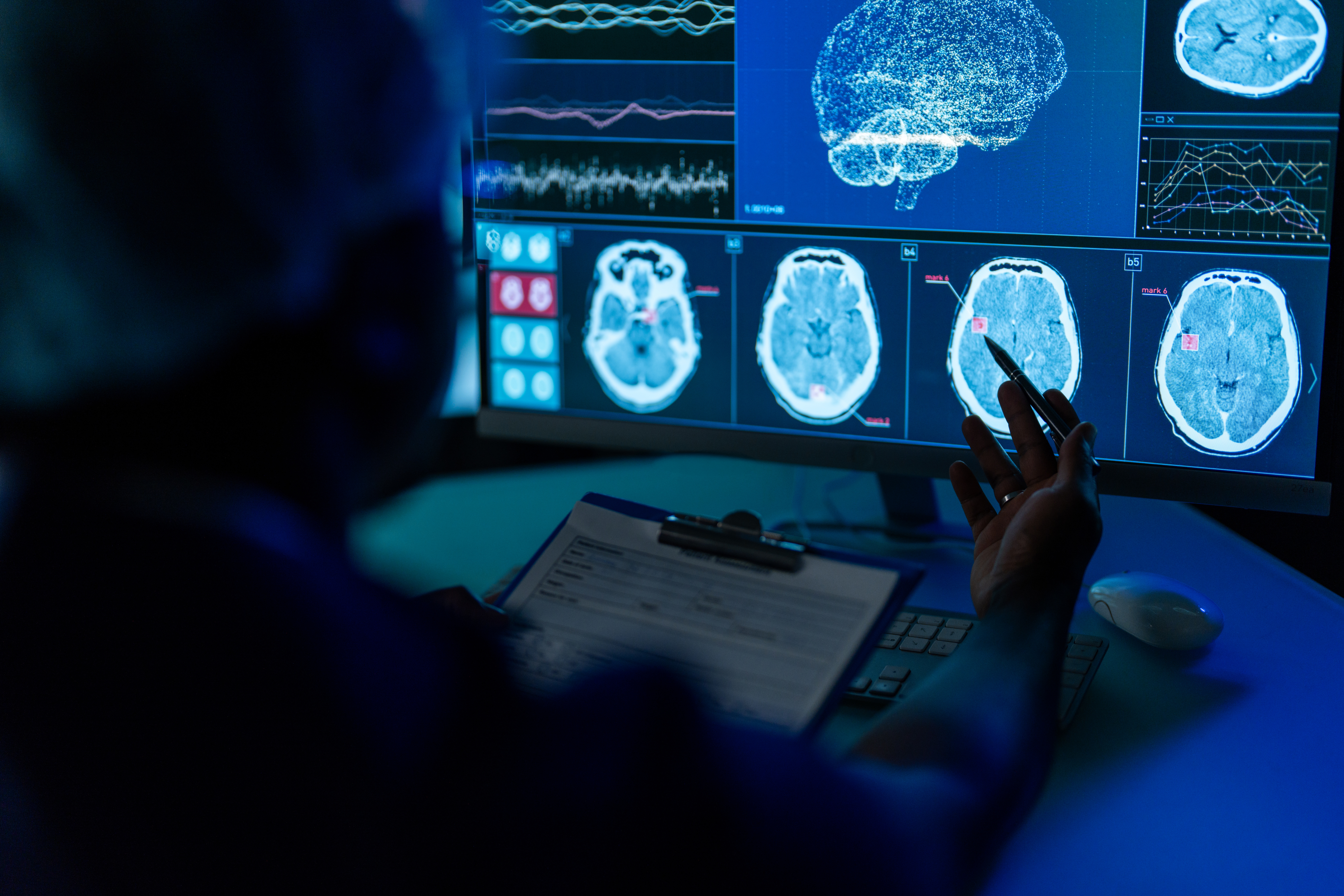 A person sits reviewing brain scans 