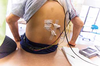 A man's back with EKG pads on him 