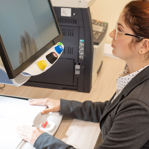 woman with disability in front of monitor in a working environment. 