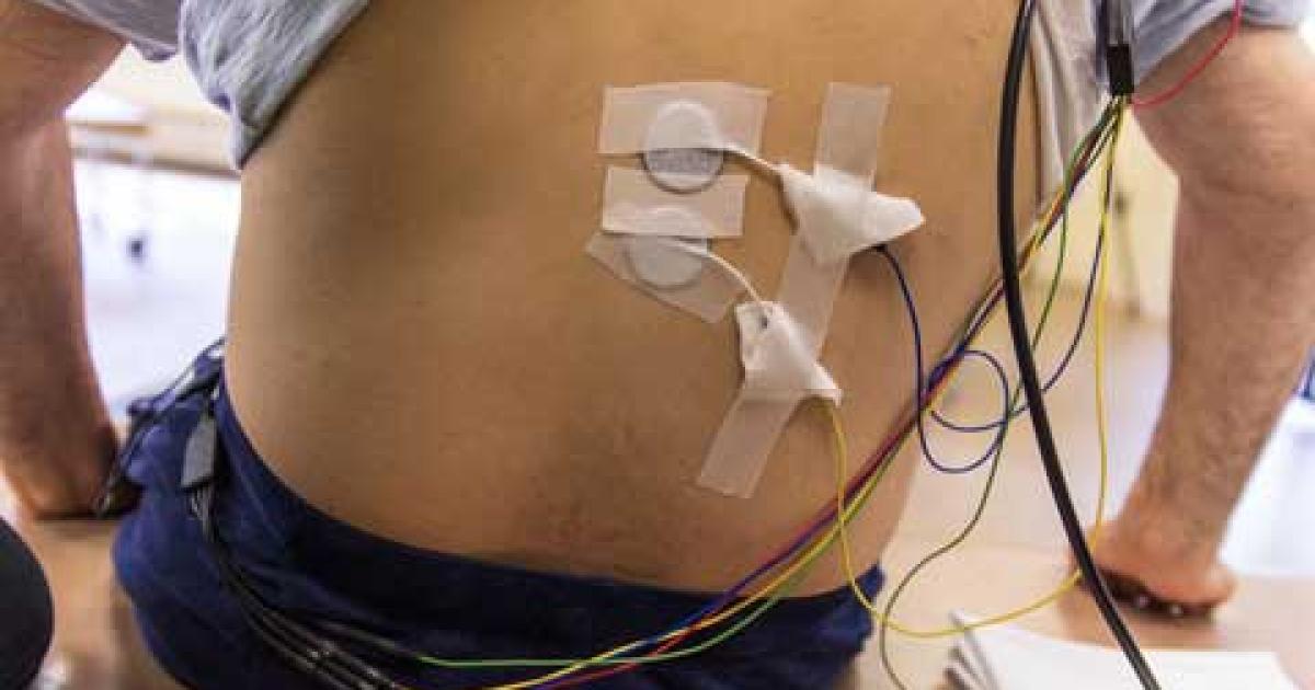 Patients with baclofen pumps may safely undergo transcutaneous spinal
