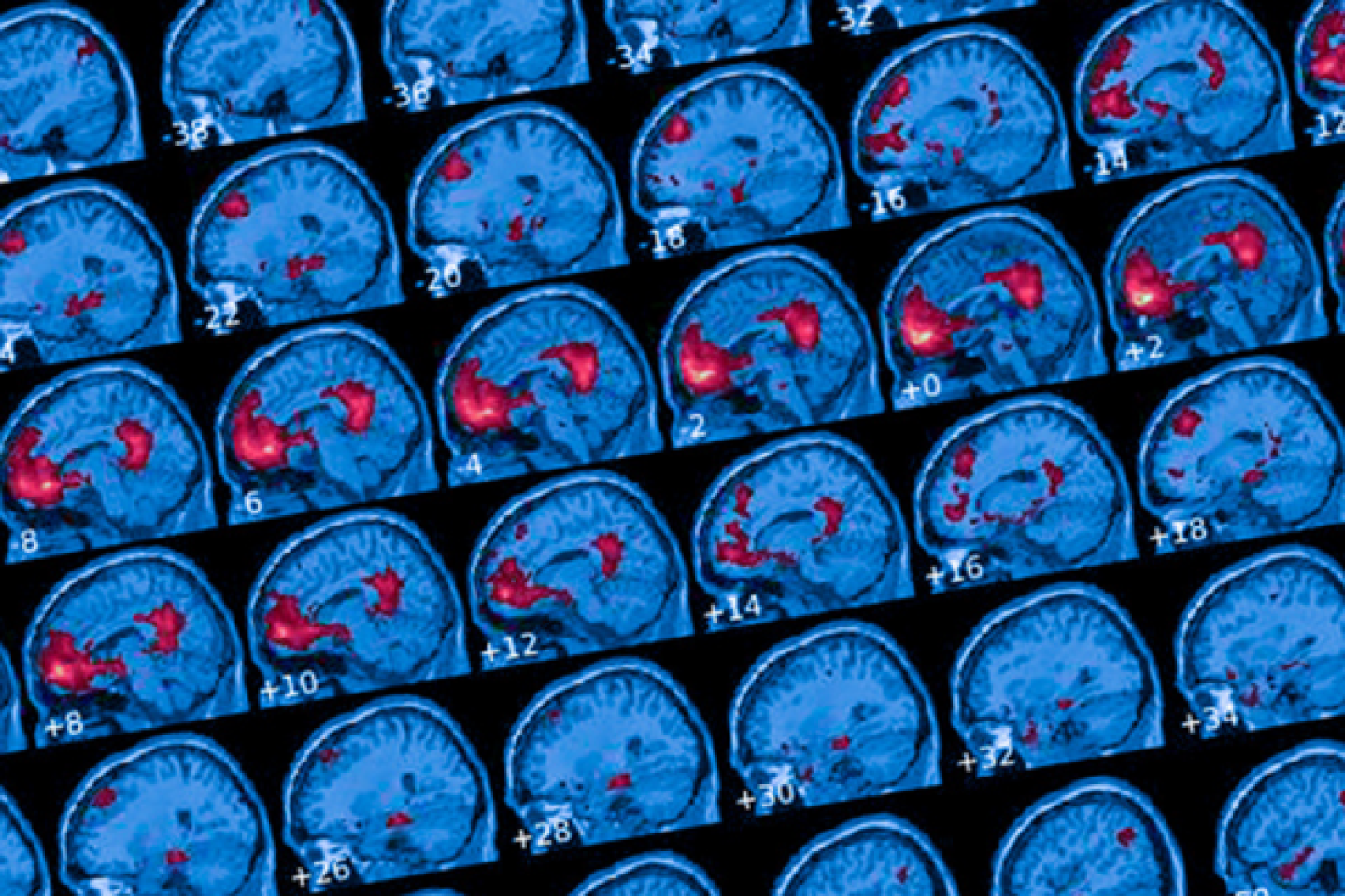 image of scanned brain