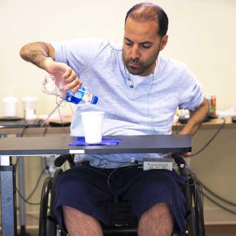 Transcutaneous stimulation improves hand function in people with complete tetraplegia