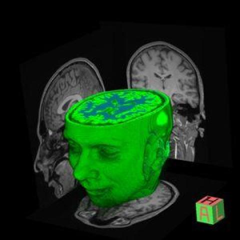 green model head with top cut off to show brain