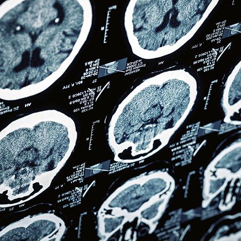 Image of brain scans