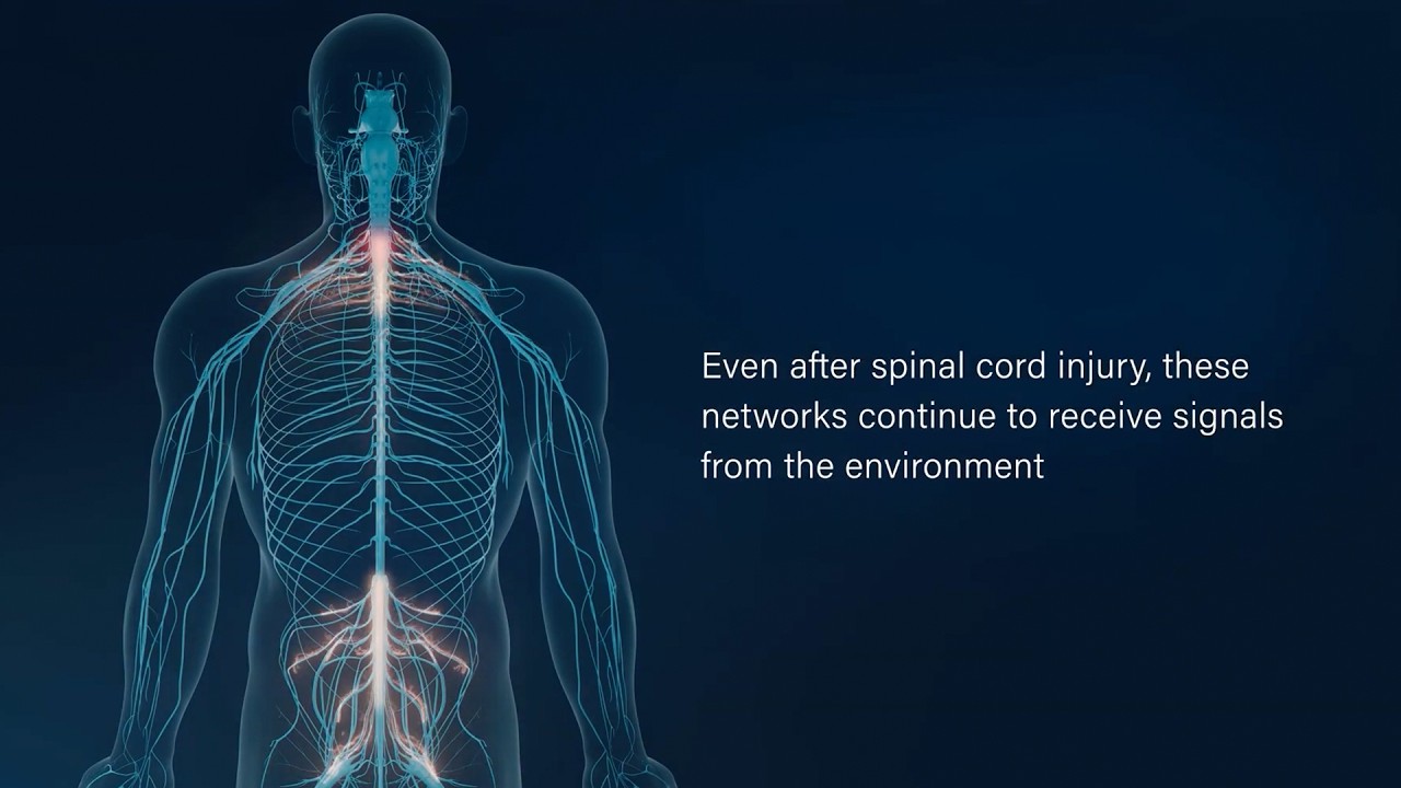 Life‑Changing Recovery After Spinal Cord Injury: The Power of Neuromodulation